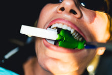 Load image into Gallery viewer, ReLeaf Restorative - Basic Setup Kit (Includes Hardware)
